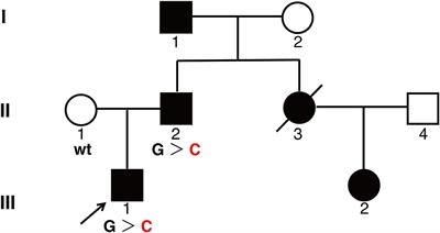 Case Report: A Missense Mutation of KIT in Hyperpigmentation and Lentigines Unassociated With Systemic Disorders: Report of a Chinese Pedigree and a Literature Review